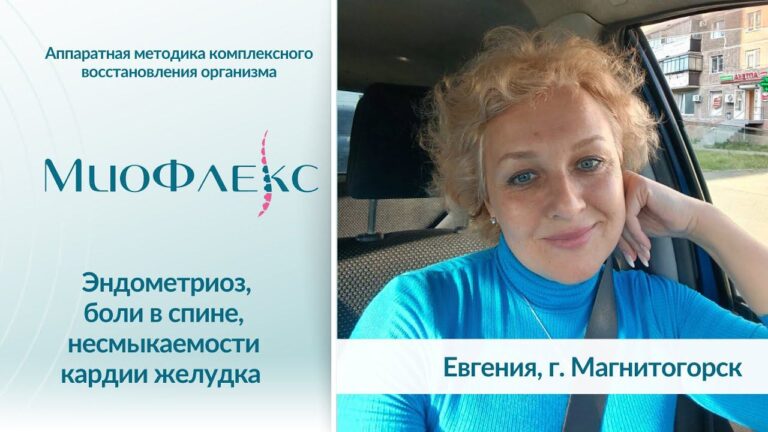 Интервью с гостем МиоФлекс | Эндометриоз, боли в спине, несмыкаемости кардии желудка и т.д.
